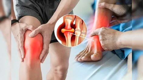 Aree della pelle adatte all'applicazione del gel Icexin (ginocchia, gomiti, parte bassa della schiena)