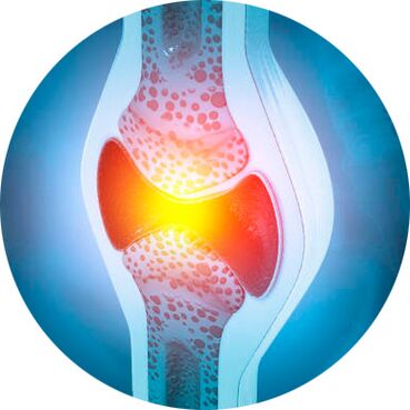 Processo di recupero articolare con gel Icexin