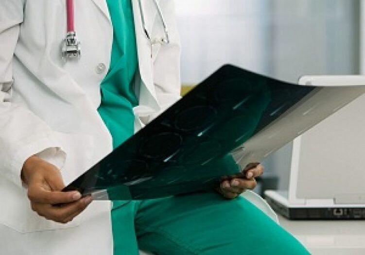 La radiografia aiuta il medico a diagnosticare l’“osteocondrosi della colonna vertebrale toracica”